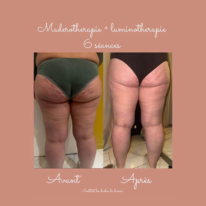 Madérothérapie Orliénas