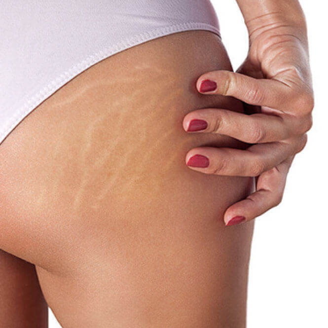 Soins minceur Orliénas